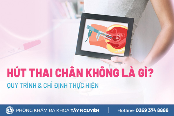 Hút thai chân không là gì? Được chỉ định khi nào và quy trình thực hiện?