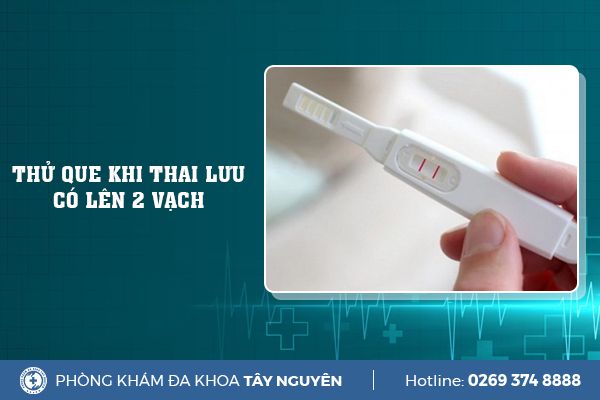 Thử que khi thai lưu có lên 2 vạch là vì sao và cần làm gì?